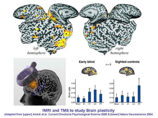 s-brain_plasticity.jpg